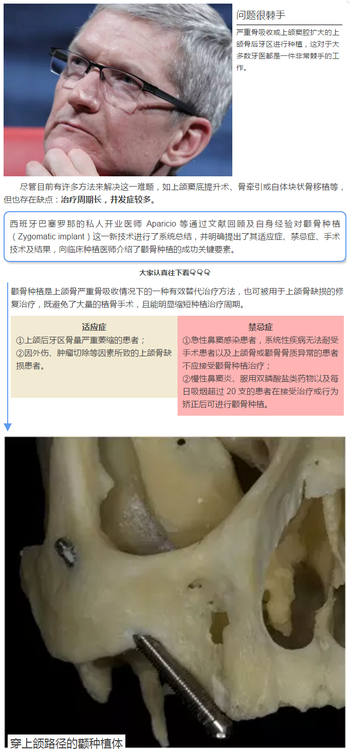 适应证(临床困难):严重骨吸收或上颌窦腔扩大的上颌骨后牙区进行种植