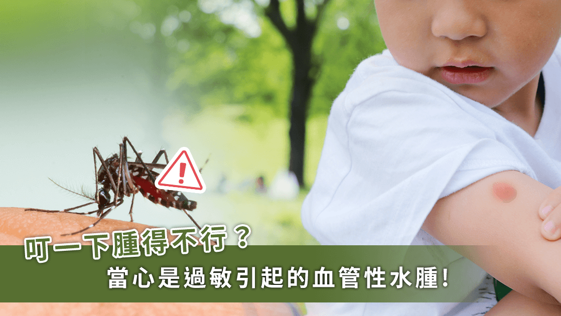幼兒被蚊子咬腫成「面龜」！小心是過敏反應引起「血管性水腫」