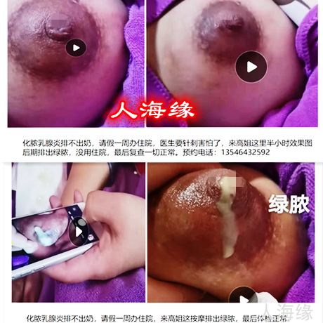 乳腺炎