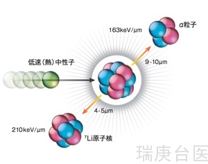 BNCT案例 | 脑膜瘤的临床研究数据