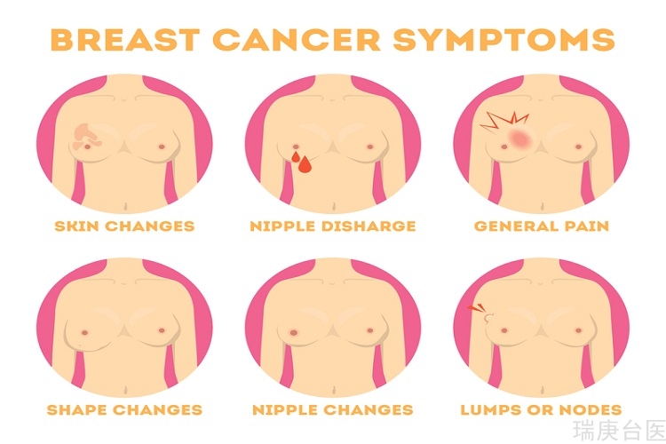 男性乳癌症状与女性相同？ 胸部有这些特征要警惕