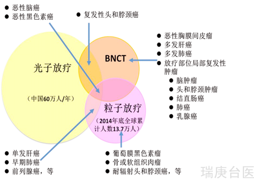 癌症患者的福音 | 杀癌神器之BNCT 治疗