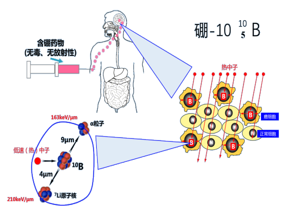 BNCT硼药有多神奇 | 30分钟杀灭癌细胞