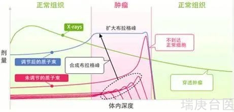 质子治疗脑膜瘤 | 肿瘤消失90%，3年无复发！