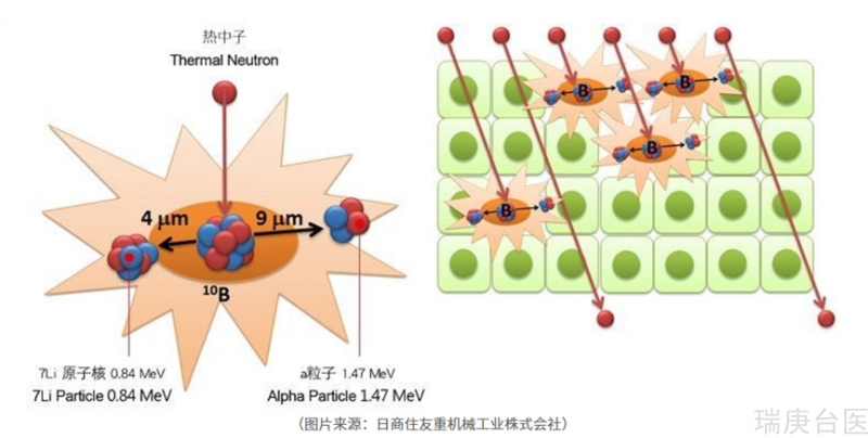 BNCT | 硼中子疗法针对所有癌症吗？