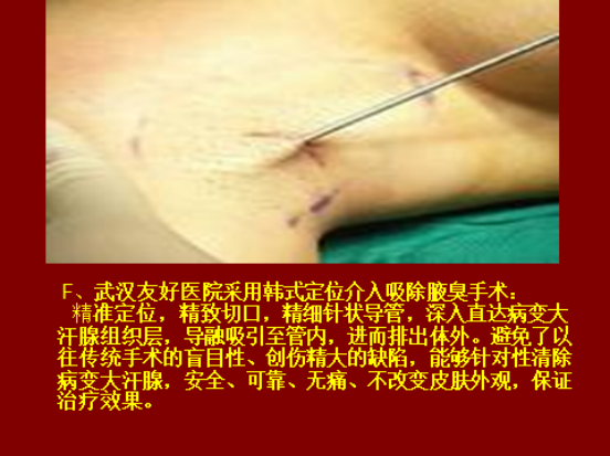 图片4(1).png