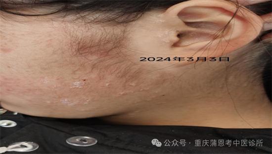 20250319210800_27945.png 640 (1).png